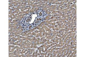 IHC analysis of PDIA6 using anti-PDIA6 antibody (ABIN7600553). (PDIA6 anticorps  (AA 20-440))