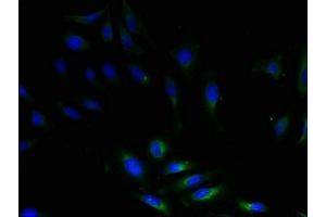 Immunofluorescent analysis of Hela cells using ABIN7149863 at dilution of 1:100 and Alexa Fluor 488-congugated AffiniPure Goat Anti-Rabbit IgG(H+L)