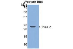 Western blot analysis of the recombinant protein. (TNFRSF11A anticorps  (AA 359-542))