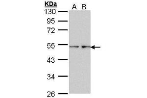 WB Image Sample (30 ug of whole cell lysate) A: HeLa B: Hep G2 , 7. (Fascin anticorps  (Internal Region))