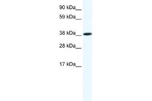 WB Suggested Anti-OBOX6 Antibody Titration:  1. (OBOX6 anticorps  (Middle Region))