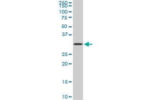 STX4A monoclonal antibody (M04), clone 6D1. (Syntaxin 4 anticorps  (AA 19-119))