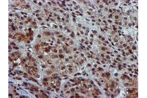 Image no. 14 for anti-Glutathione S-Transferase theta 2 (GSTT2) antibody (ABIN1498553) (GSTT2 anticorps)