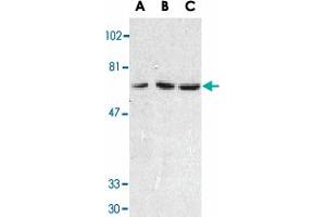 Western blot analysis of TNFRSF10C in HeLa cell (A), mouse (B) and rat (C) liver tissue lysates with TNFRSF10C polyclonal antibody  at 1 ug/mL . (DcR1 anticorps  (Extracellular Domain))