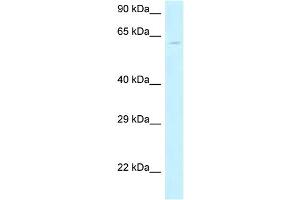 WB Suggested Anti-MON1B Antibody Titration: 1. (MON1B anticorps  (N-Term))