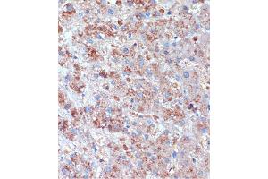 Immunohistochemistry of paraffin-embedded Human liver using TCIRG1 Rabbit pAb (ABIN7270707) at dilution of 1:100 (40x lens).