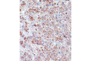 Immunohistochemistry of paraffin-embedded Human liver using TCIRG1 Rabbit pAb (ABIN7270707) at dilution of 1:100 (40x lens). (TCIRG1 anticorps  (AA 1-130))