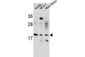 Western Blotting (WB) image for anti-Variable Charge, X-Linked (VCX) antibody (ABIN2995866) (VCX anticorps)