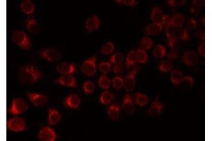 ABIN6276821 staining 293 by IF/ICC.