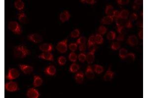 ABIN6276821 staining 293 by IF/ICC. (F12 anticorps  (C-Term))