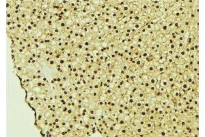 ABIN6277229 at 1/100 staining Mouse liver tissue by IHC-P.
