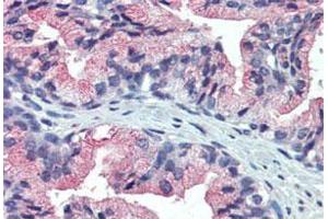 Immunohistochemistry (Formalin/PFA-fixed paraffin-embedded sections) of human prostate with TM9SF3 polyclonal antibody . (TM9SF3 anticorps  (Internal Region))