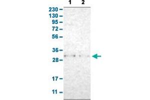 Western Blot analysis with TNFAIP1 polyclonal antibody . (TNFAIP1 anticorps  (AA 80-170))