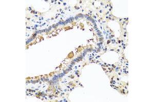 Immunohistochemistry of paraffin-embedded rat lung using CHI3L2 antibody (ABIN5975154) at dilution of 1/100 (40x lens). (CHI3L2 anticorps)