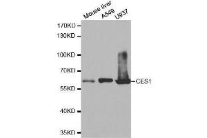 Western blot analysis of extracts of various cell lines, using CES1 antibody. (CES1 anticorps  (AA 287-566))