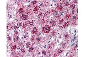 Anti-LDL Receptor antibody IHC of human liver.