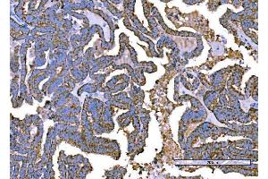 IHC analysis of RALBP1 using anti-RALBP1 antibody (ABIN7600800). (RALBP1 anticorps  (AA 239-506))