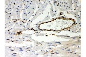 Anti- Vimentin Picoband antibody, IHC(P) IHC(P): Mouse Cardiac Muscle Tissue