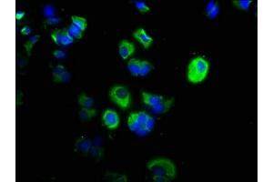 Immunofluorescence staining of MCF-7 cells with ABIN7146522 at 1:200, counter-stained with DAPI. (CAPNL1 anticorps  (Catalytic Subunit))