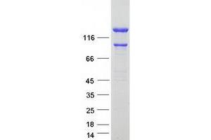 Validation with Western Blot