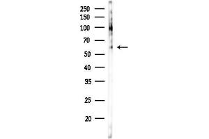 Western blot analysis of lysates from COLO205 cells, using Phospho-p62Dok (Tyr398) Antibody at 1/1000 dilution.