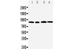 Anti-CD168 antibody, Western blotting Lane 1: MM231 Cell Lysate Lane 2: MM453 Cell Lysate Lane 3: HELA Cell Lysate Lane 4: A549 Cell Lysate (HMMR anticorps  (C-Term))