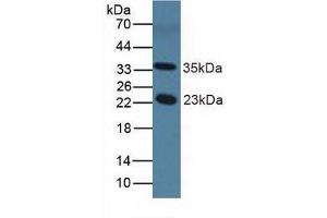 Detection of NOS1AP in Mouse Serum using Polyclonal Antibody to Nitric Oxide Synthase 1 Adaptor Protein (NOS1AP) (NOS1AP anticorps  (AA 19-251))