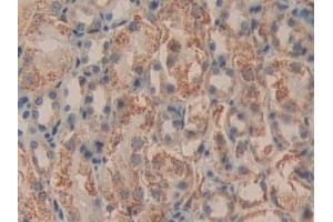 Detection of DLD in Mouse Kidney Tissue using Polyclonal Antibody to Dihydrolipoyl Dehydrogenase (DLD) (DLD anticorps  (AA 45-271))
