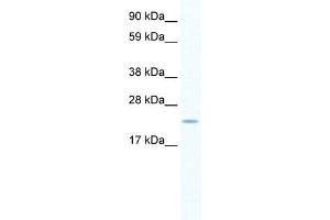 WB Suggested Anti-SERTAD1 Antibody   Titration: 0. (SERTAD1 anticorps  (N-Term))