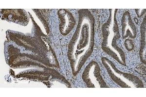 IHC analysis of U2AF65/U2AF2 using anti U2AF65/U2AF2 antibody (ABIN7600794). (U2AF2 anticorps  (AA 238-470))