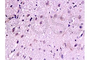 Formalin-fixed and paraffin embedded: rat brain tissue labeled with Anti-TrkB Polyclonal Antibody, Unconjugated (ABIN727310) at 1:200, followed by conjugation to the secondary antibody and DAB staining