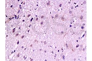 Formalin-fixed and paraffin embedded: rat brain tissue labeled with Anti-TrkB Polyclonal Antibody, Unconjugated (ABIN727310) at 1:200, followed by conjugation to the secondary antibody and DAB staining (TRKB anticorps  (AA 32-120))