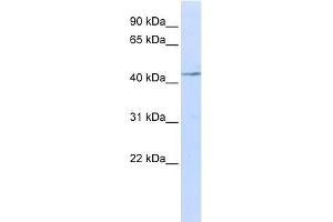 WB Suggested Anti-IL11RA Antibody Titration:  0. (IL11RA anticorps  (N-Term))