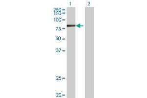 Lane 1: DMPK transfected lysate ( 69. (DMPK 293T Cell Transient Overexpression Lysate(Denatured))