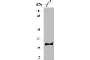 Western Blot analysis of HeLa cells using Rim4 Polyclonal Antibody (RIMS4 anticorps  (Internal Region))
