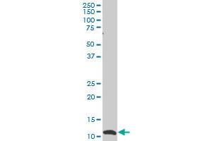 SNAPC5 monoclonal antibody (M02), clone 5C3 Western Blot analysis of SNAPC5 expression in HL-60 .