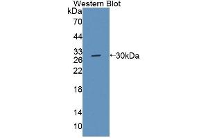 Western blot analysis of the recombinant protein. (ABCC6 anticorps  (AA 1260-1498))