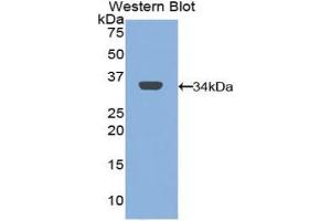 Detection of Recombinant MRC1, Mouse using Polyclonal Antibody to Mannose Receptor C Type 1 (MRC1)
