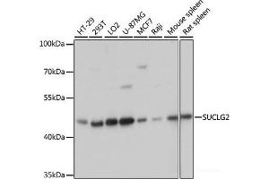 Western blot analysis of extracts of various cell lines using SUCLG2 Polyclonal Antibody at dilution of 1:3000. (SUCLG2 anticorps)