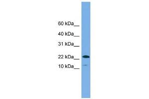 WFDC1 antibody used at 1 ug/ml to detect target protein. (WFDC1 anticorps  (N-Term))