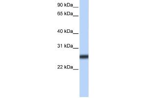 TMPRSS5 antibody used at 2 ug/ml to detect target protein. (TMPRSS5 anticorps)