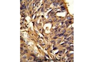 Immunohistochemistry (IHC) image for anti-Electron-Transferring-Flavoprotein Dehydrogenase (ETFDH) antibody (ABIN3002851)