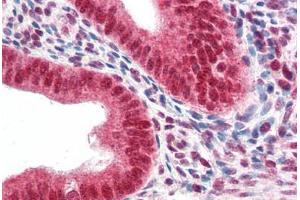 Human Uterus (formalin-fixed, paraffin-embedded) stained with CBX5 antibody ABIN337121 at 2. (CBX5 anticorps  (AA 88-102))