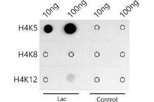 Dot-blot analysis of all sorts of peptides using Acetyl-Histone H4-K5 antibody (ABIN7267743) at 1:1000 dilution. (Histone H4 anticorps  (acLys5))