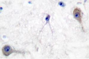 Image no. 1 for anti-Patched 1 (PTCH1) antibody (ABIN271777) (Patched 1 anticorps)