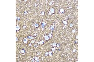 Immunohistochemistry of paraffin-embedded human brain using SN Rabbit pAb (ABIN3021231, ABIN3021232, ABIN3021233 and ABIN6214078) at dilution of 1:100 (40x lens). (SNAP25 anticorps  (AA 1-206))