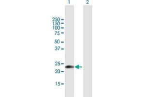 Western Blot analysis of EDN1 expression in transfected 293T cell line by EDN1 MaxPab polyclonal antibody.