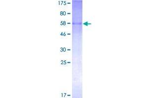 Image no. 1 for ST3 beta-Galactoside alpha-2,3-Sialyltransferase 2 (ST3GAL2) (AA 1-350) protein (GST tag) (ABIN1321482)
