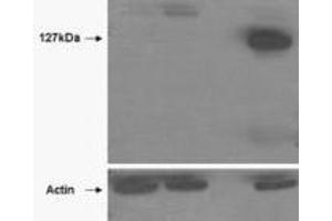 Western Blotting (WB) image for anti-Tankyrase, TRF1-Interacting Ankyrin-Related ADP-Ribose Polymerase 2 (TNKS2) (Internal Region) antibody (ABIN2464159) (TNKS2 anticorps  (Internal Region))