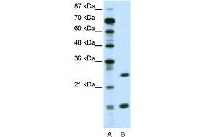 WB Suggested Anti-CEBPG Antibody Titration:  0. (CEBPG anticorps  (N-Term))